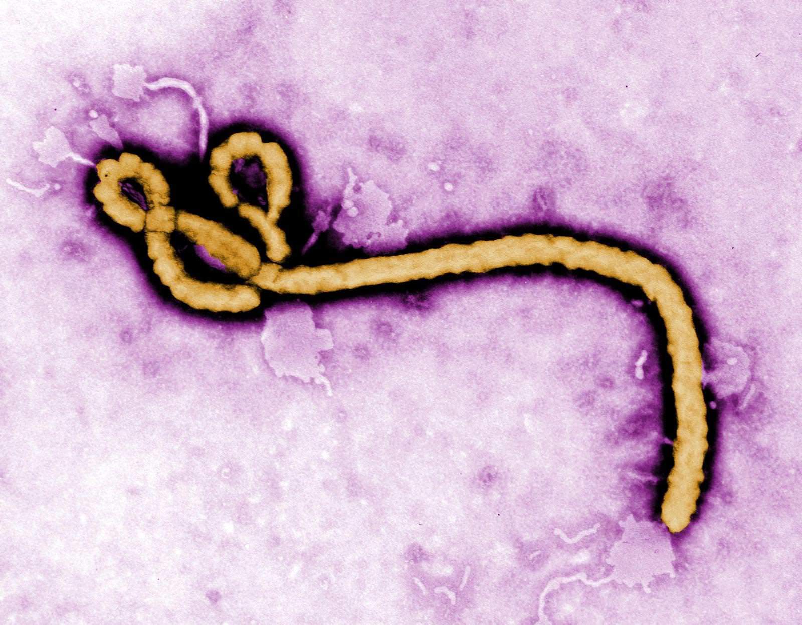 Lees meer over het artikel Preppen tegen het Ebola virus